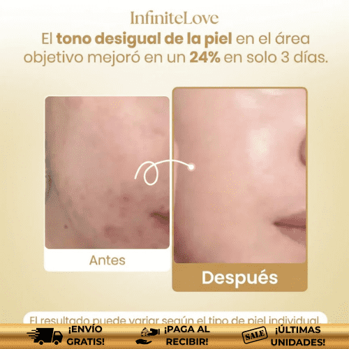 LUMIMASK™ | Mascarilla coreana nocturna para manchas, melasma y brillo Instantáneo