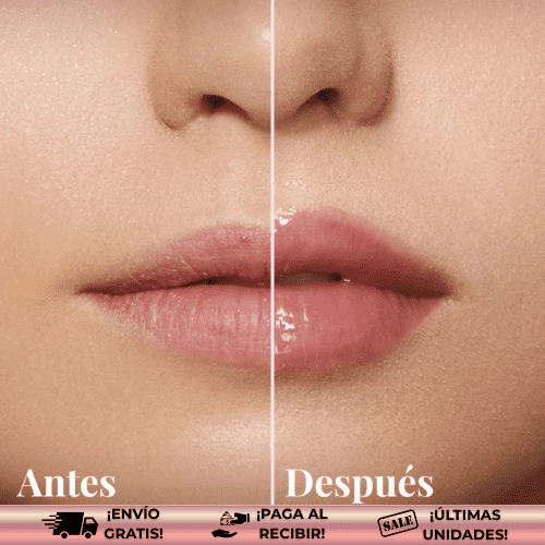 MaxLips™ | Voluminizador de labios